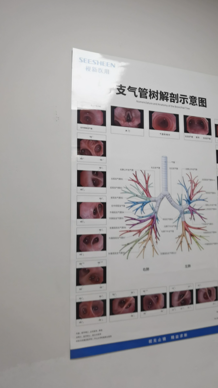 支气管树解剖图谱