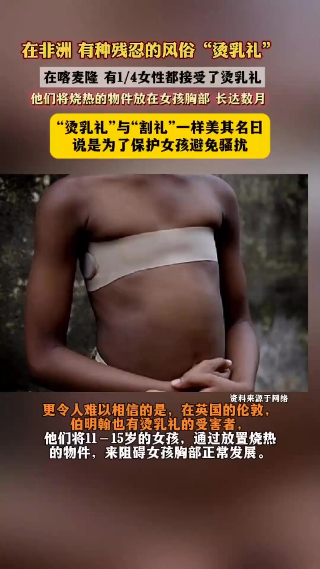 在非洲有种残忍的“烫乳礼”,将烧热的物件放在女孩胸部拒绝发育