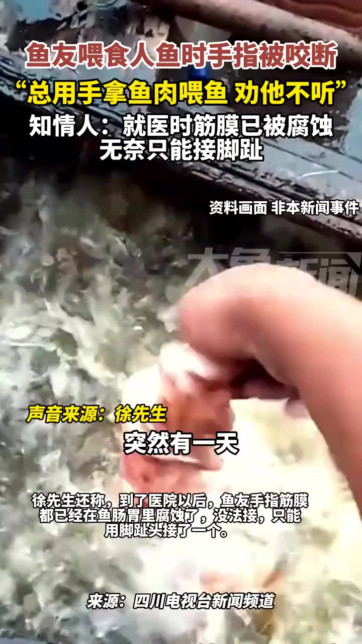 鱼友总喜欢用手拿肉喂食人鱼,手指被咬断