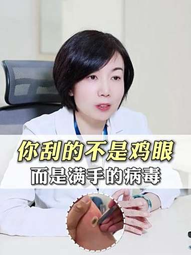 这可不是鸡眼，别再用刀刮了，当心越长越多！鸡眼 跖疣 HPV 抖出健康知识宝藏 健康科普破