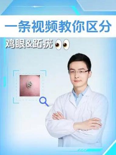 一条视频教你区分,鸡眼 和 跖疣 皮肤病 医学科普