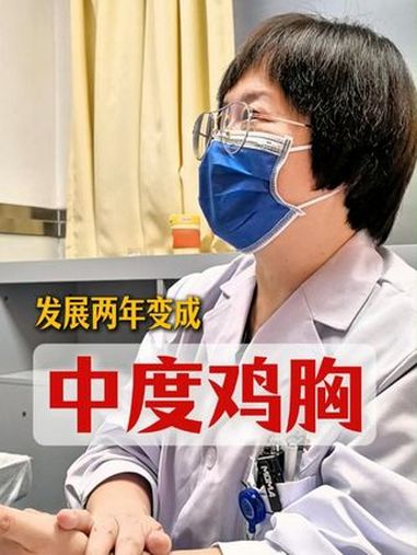 孩子两年前发现鸡胸,之后家长盲目补钙,导致孩子变成中度鸡胸。鸡胸 健康科普 医学科普 门诊