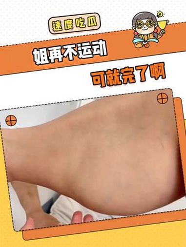 姐这腿看着已经有点吓人了啊 小腿 肌肉 节食 运动 肌肉萎缩