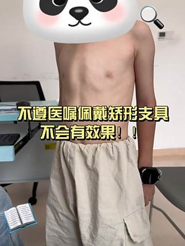 不遵医嘱佩戴矫形支具，是不会有效果的 鸡胸 肋骨外翻 儿童胸外科李飞 漏斗胸 抖出健康知识