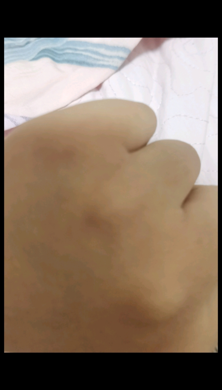 遛大狗首先要熟悉要戴手套,我这就是带着手套被轻咬了还有疤
