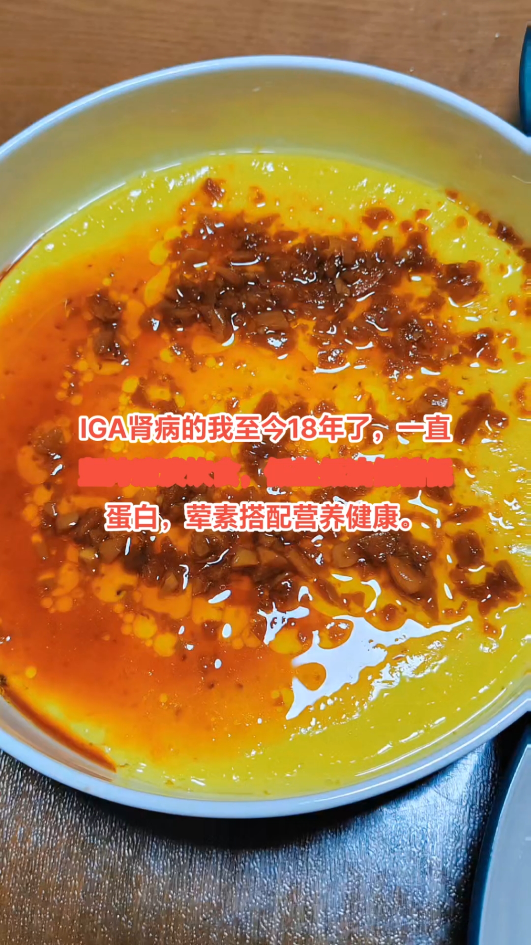 血肌酐,蛋白尿,IGA肾病,18年的肾斗士饮食生活分享。