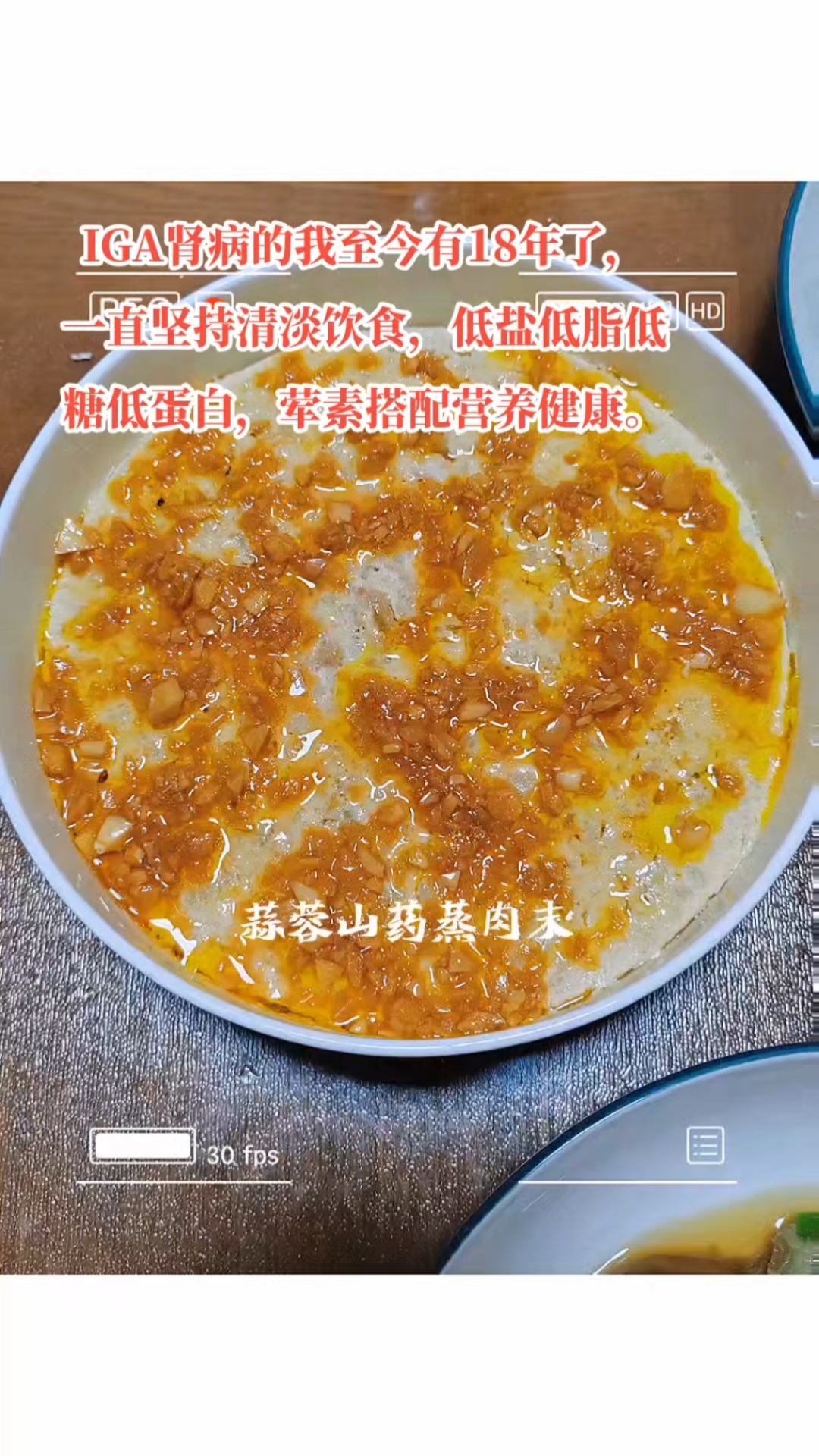 血肌酐,蛋白尿,IGA肾病,肾病饮食。