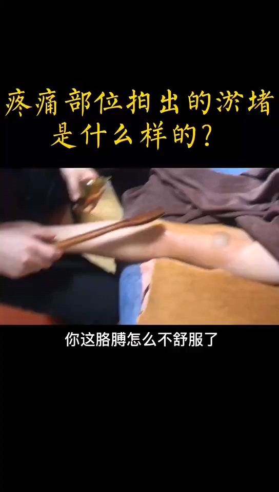 胳膊难受,拍出来鸡蛋大的鼓包。
