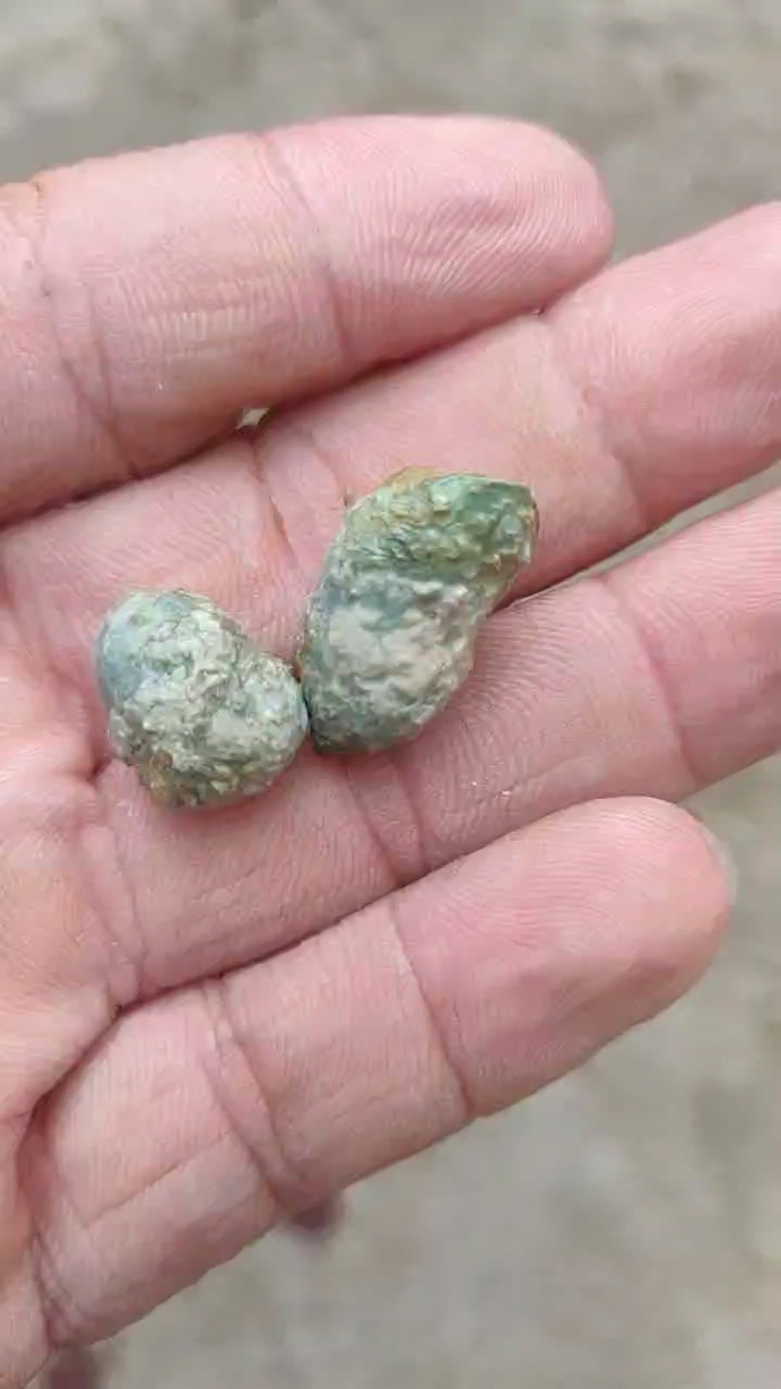 鸡结石有人要吗,