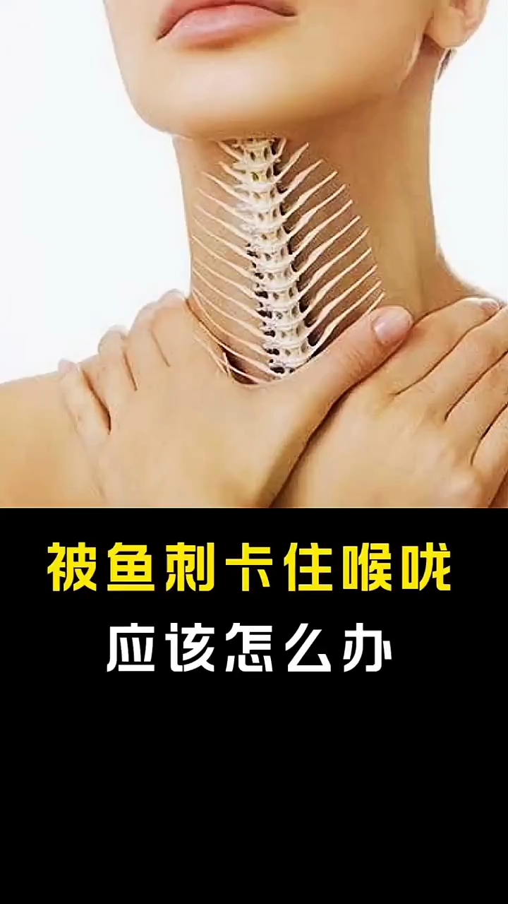 被鱼刺卡住喉咙应该怎么办？