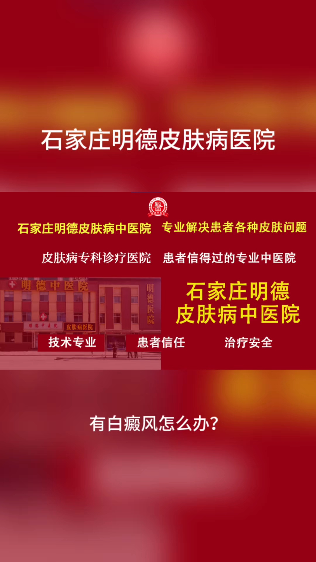 石家庄看白癜风最好的医院一石家庄皮肤病医院哪家好