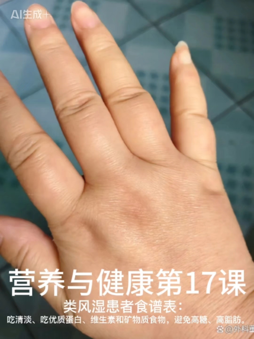 类风湿患者食谱表：吃清淡、易消化且营养均衡的原则