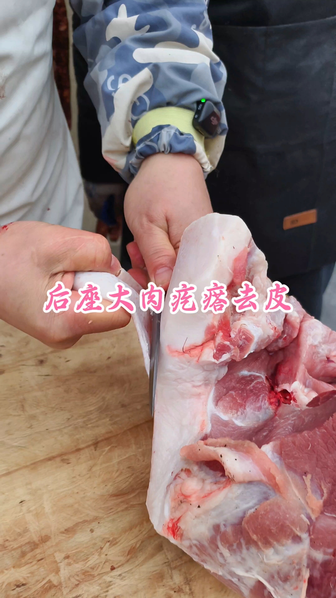 后座大肉疙瘩去皮
