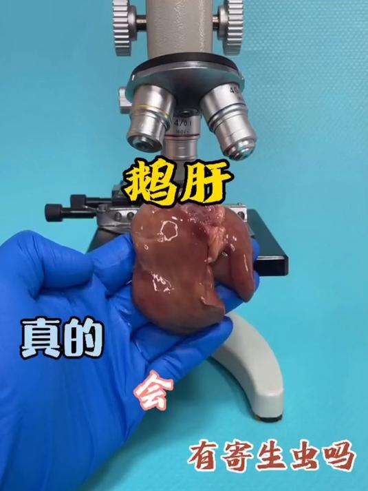 你还敢吃生鹅肝吗?