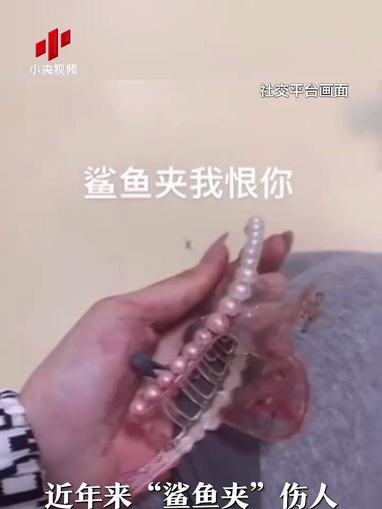 太危险了!女子戴“鲨鱼夹”摔倒不幸成植物人