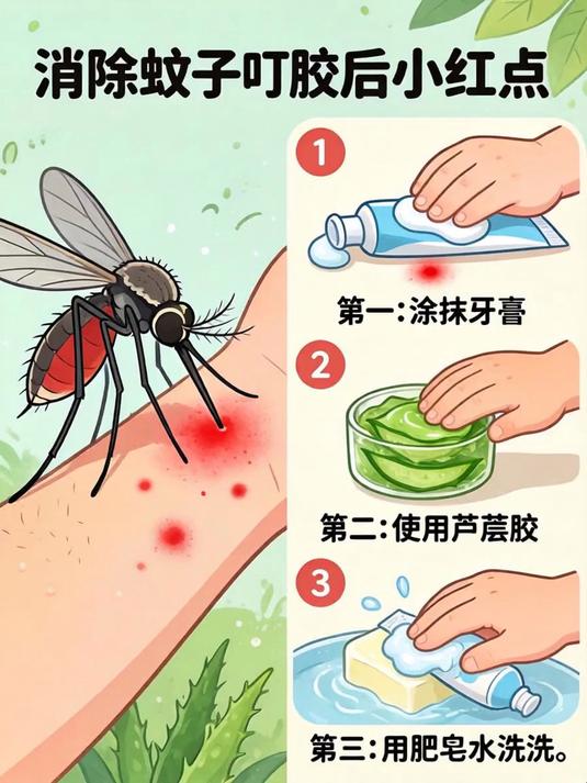 蚊子咬的小红点怎么消?3个土方法让你1小时内不留疤