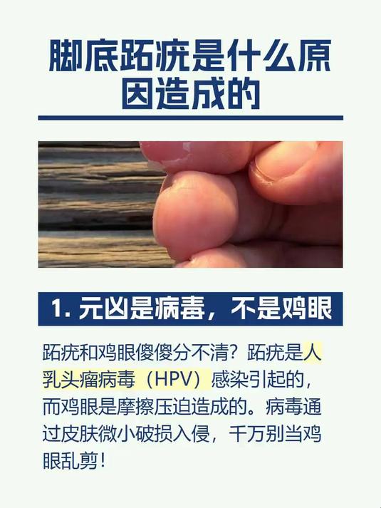 脚底跖疣是什么原因造成的