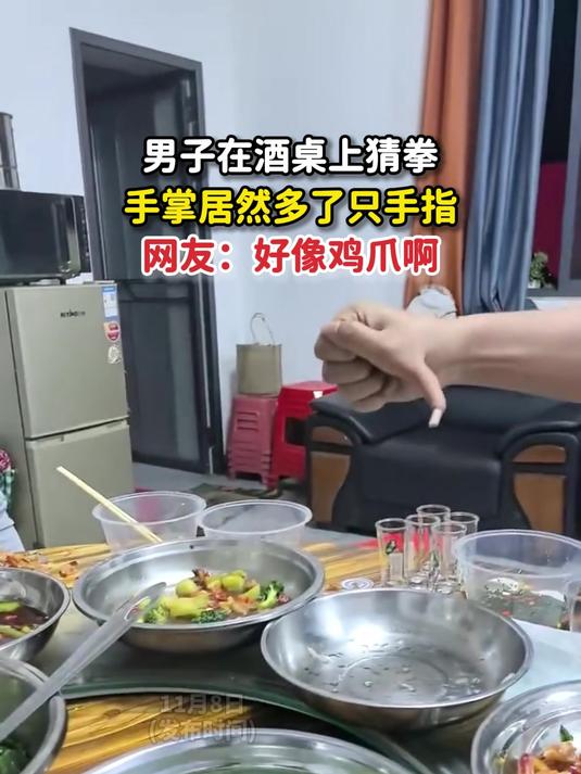 男子在酒桌上猜拳,手掌居然多了只手指,网友:好像鸡爪啊
