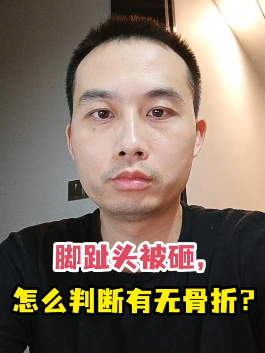 脚趾头被砸,怎么判断有无骨折?