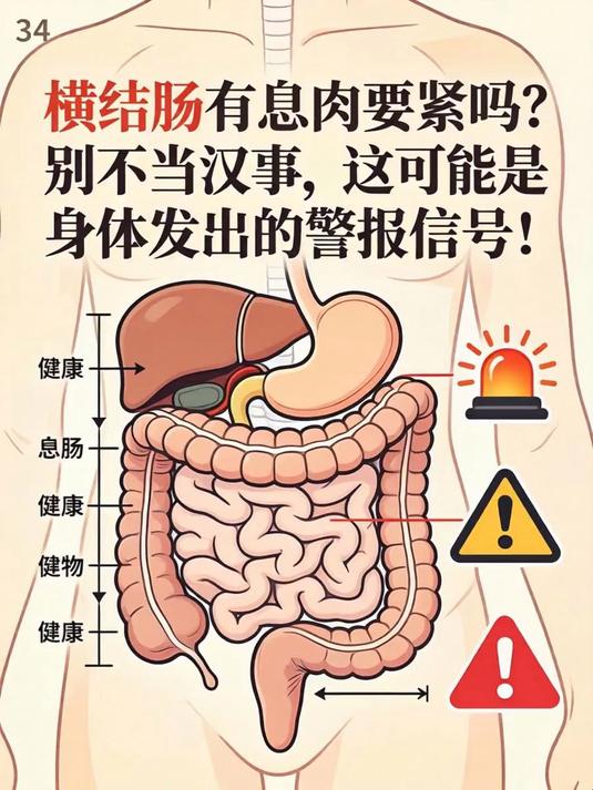 横结肠有息肉要紧吗？别不当回事，这可能是身体发出的警报信号！