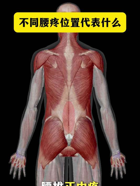 不同位置腰痛代表了什么?