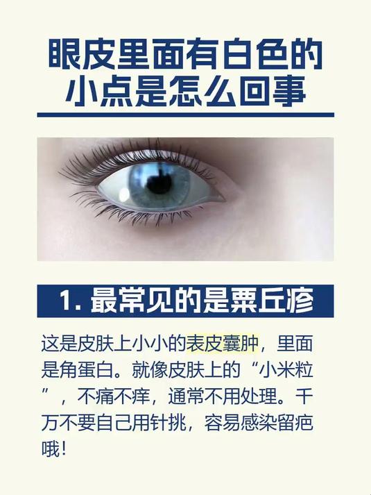 眼皮里面有白色的小点是怎么回事