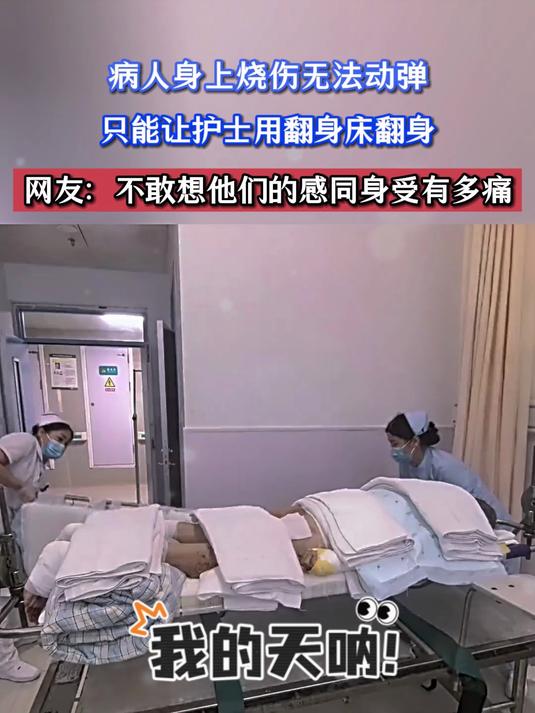 病人身上烧伤无法动弹,只能让护土用翻身床翻身