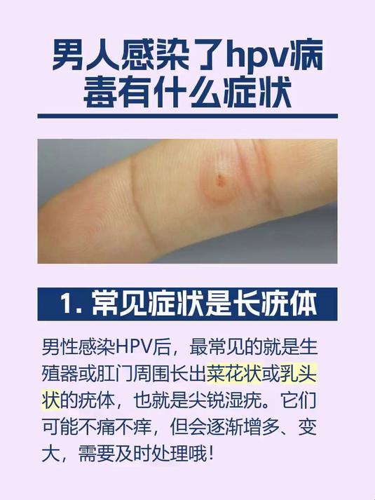 #马上健康过大年#男人感染了hpv病毒有什么症状