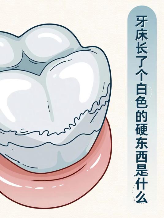 牙床长了个白色的硬东西是什么