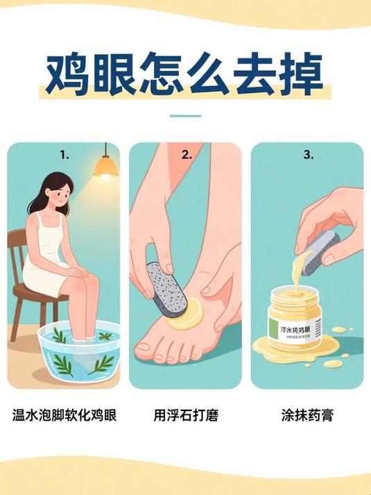 鸡眼怎么去掉 #健康扬帆季#