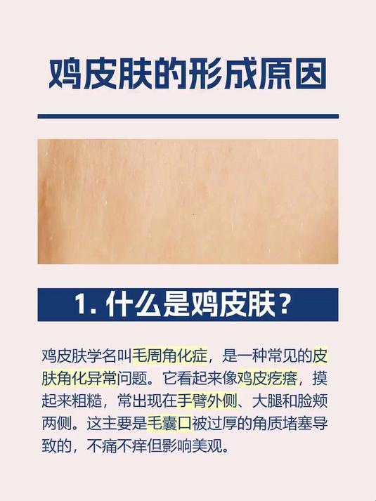 鸡皮肤的形成原因