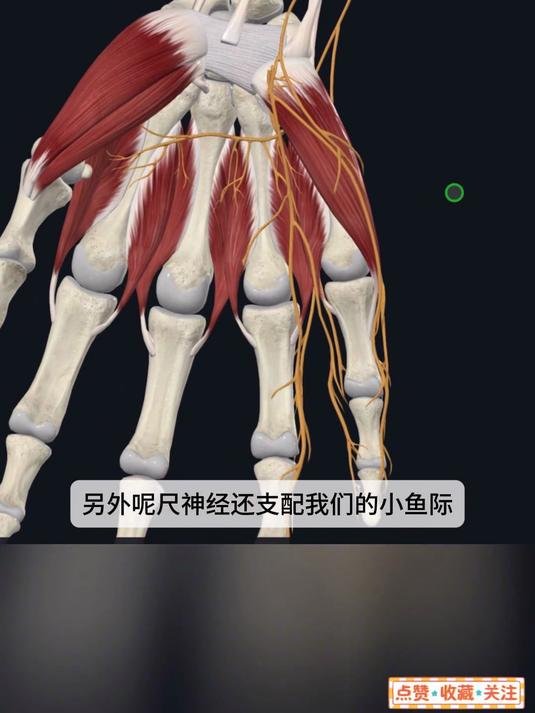 手麻-肘管综合征：尺神经卡压