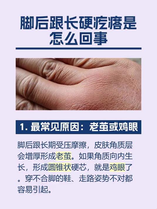 脚后跟长硬疙瘩是怎么回事
