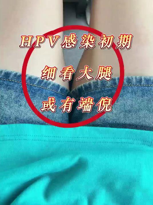 hpv感染初期,细看大腿,或有端倪
