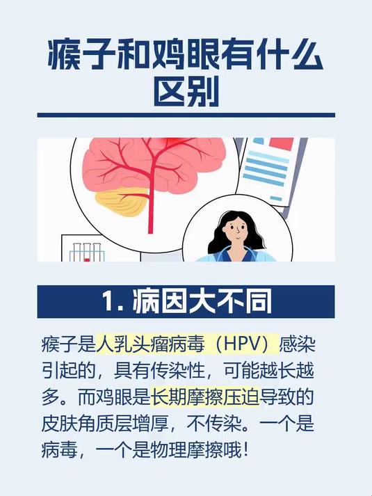 瘊子和鸡眼有什么区别