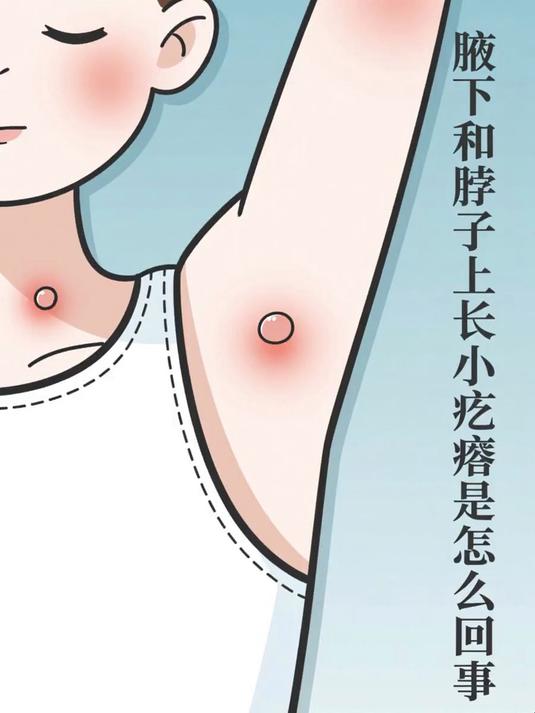 腋下和脖子上长小疙瘩是怎么回事