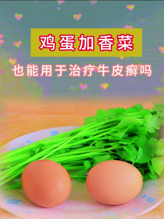 鸡蛋加香菜 也能用于治疗牛皮癣吗