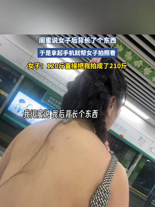 闺蜜说女子后背长了个东西,于是拿起手机就帮女子拍照看
