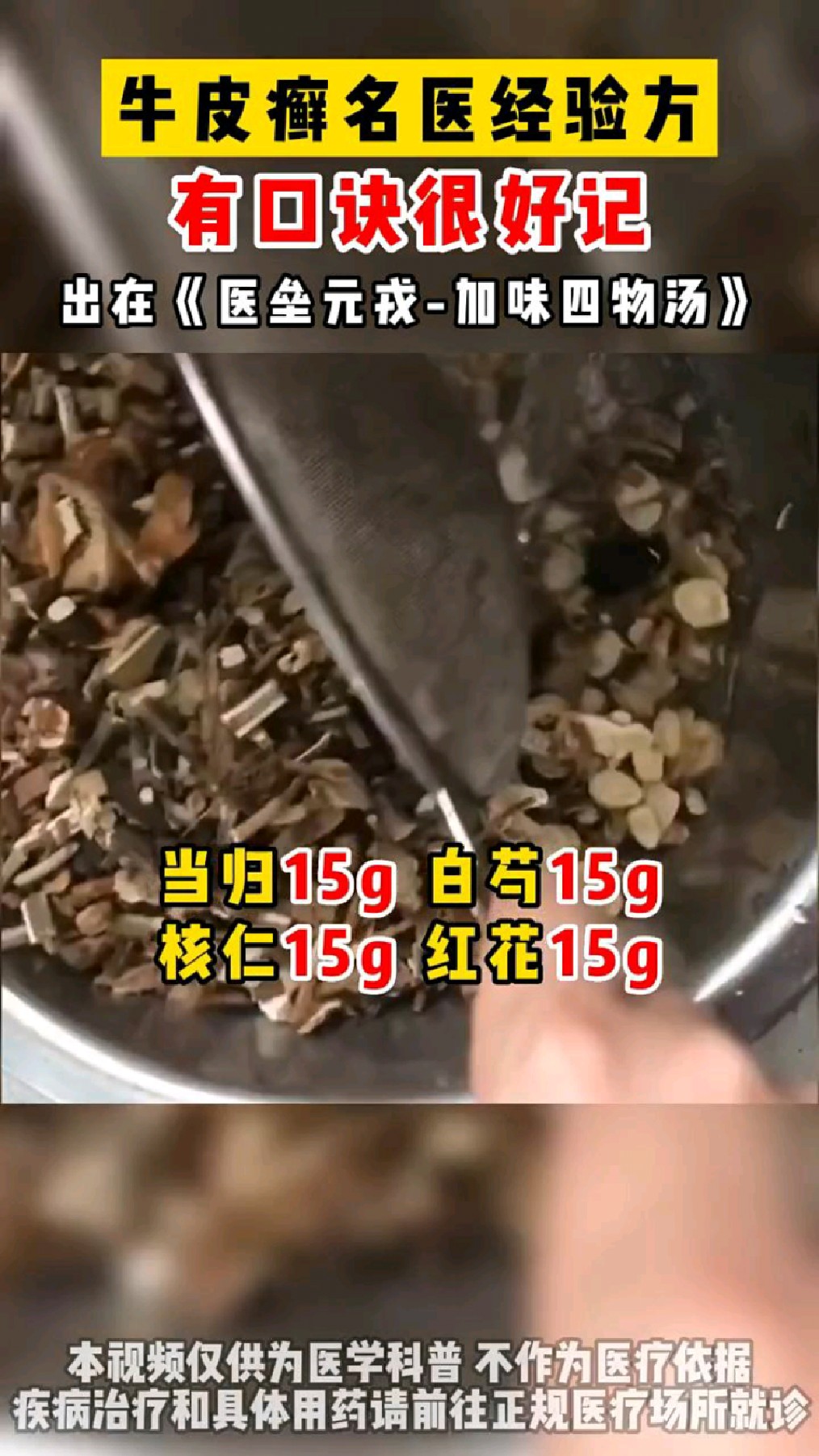 牛皮癣名医经验方,有口诀很好记