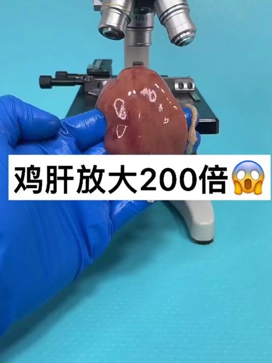 鸡肝真的卫生吗……