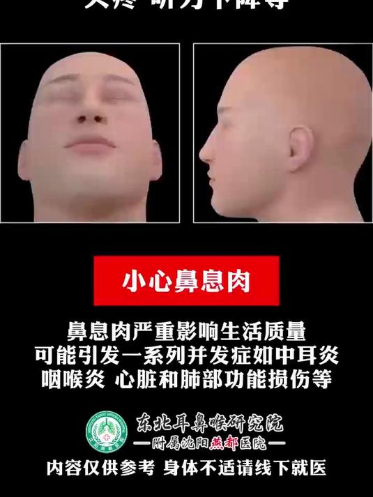 「鼻息肉」的症状如下 请大家自查!