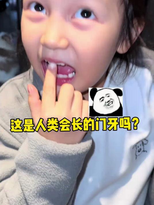 61. 这是人类会长的门牙吗？！王小麦的精神世界 换牙