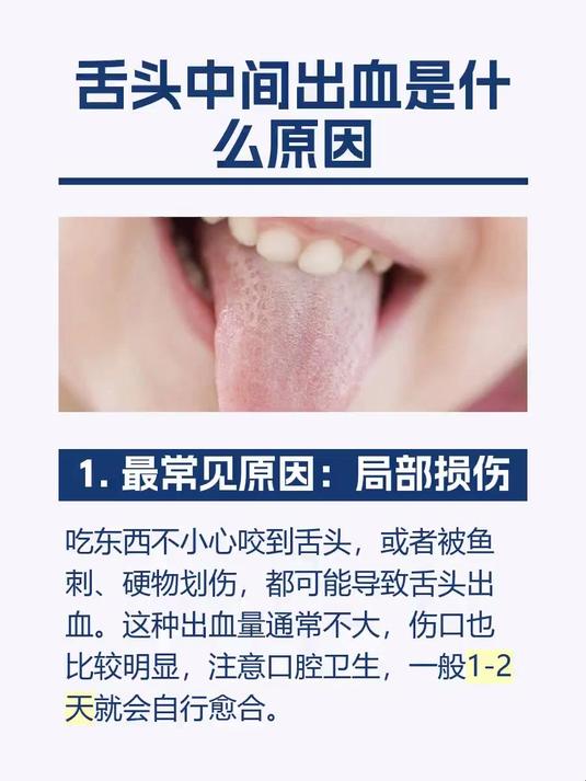 舌头中间出血是什么原因