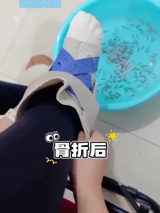 女子拆石膏后泡脚做鱼疗,结果脚一下水,鱼就不行了