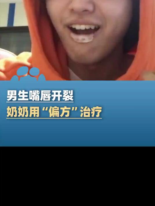 男生嘴唇开裂 奶奶用“偏方”治疗,鸡蛋壳内的薄膜敷到伤口上,男生:确实好使,两三个小时就愈