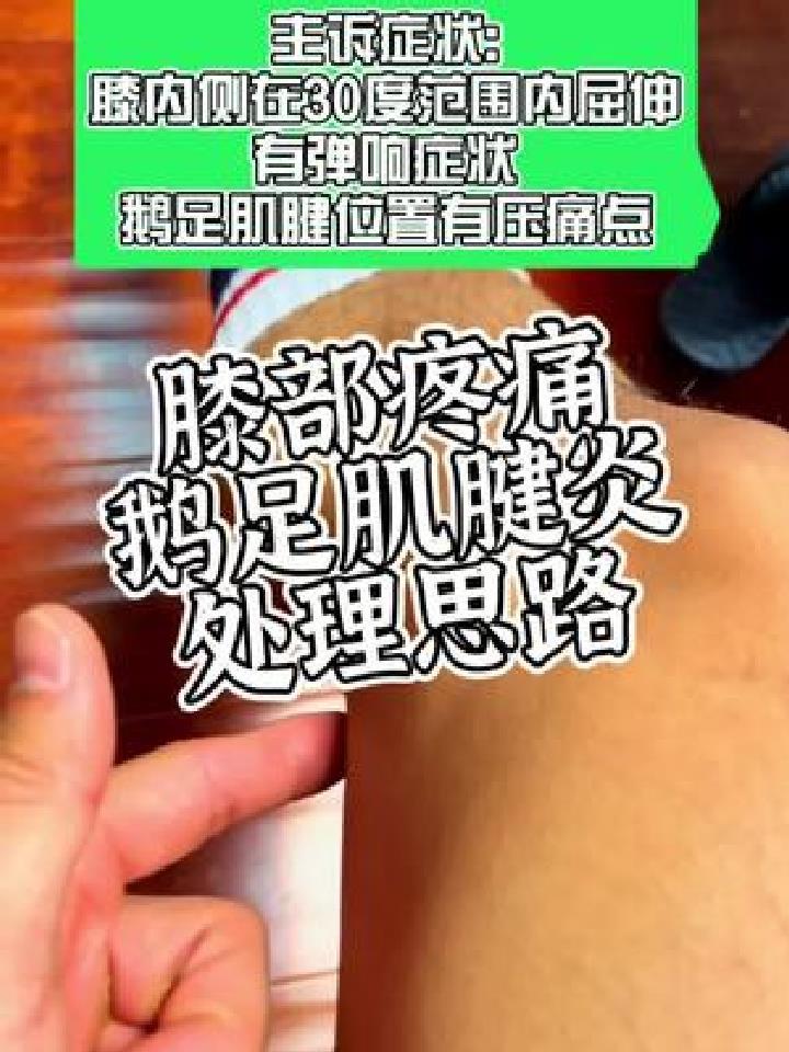 膝内侧痛,鹅足肌腱损伤处理思路