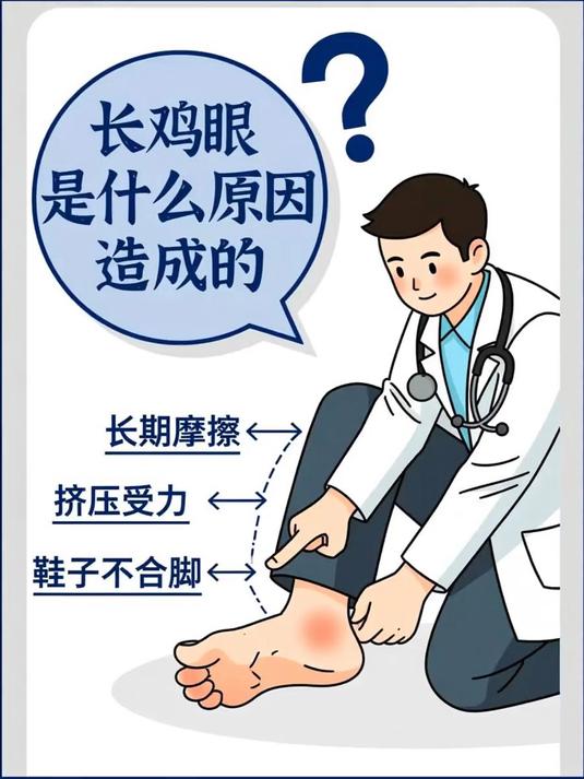长鸡眼是什么原因造成的