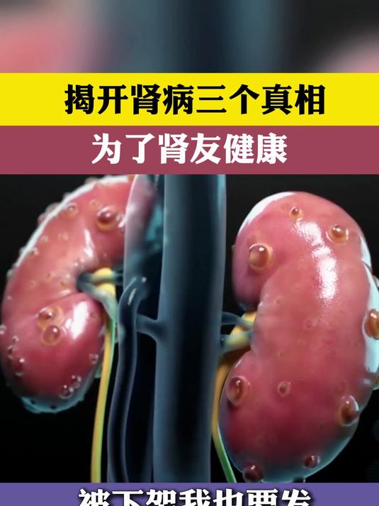 揭开肾病三个真相，为了肾友的健康，被下架我也要发