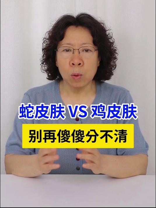 蛇皮肤 VS 鸡皮肤，别再傻傻分不清！