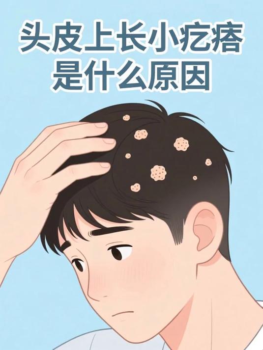 头皮上长小疙瘩是什么原因